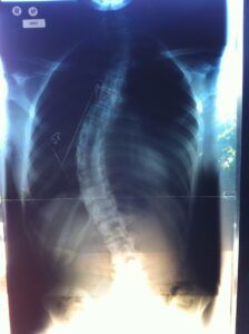 Before surgery