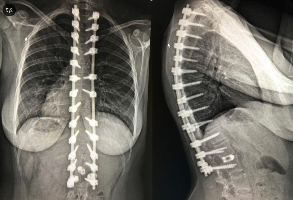 morgans xray