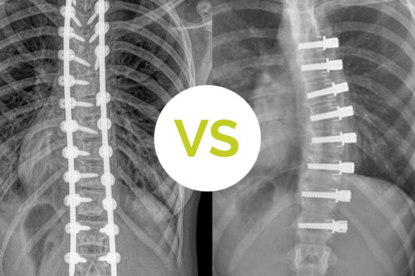 psf vs vbt, shared decision making tool