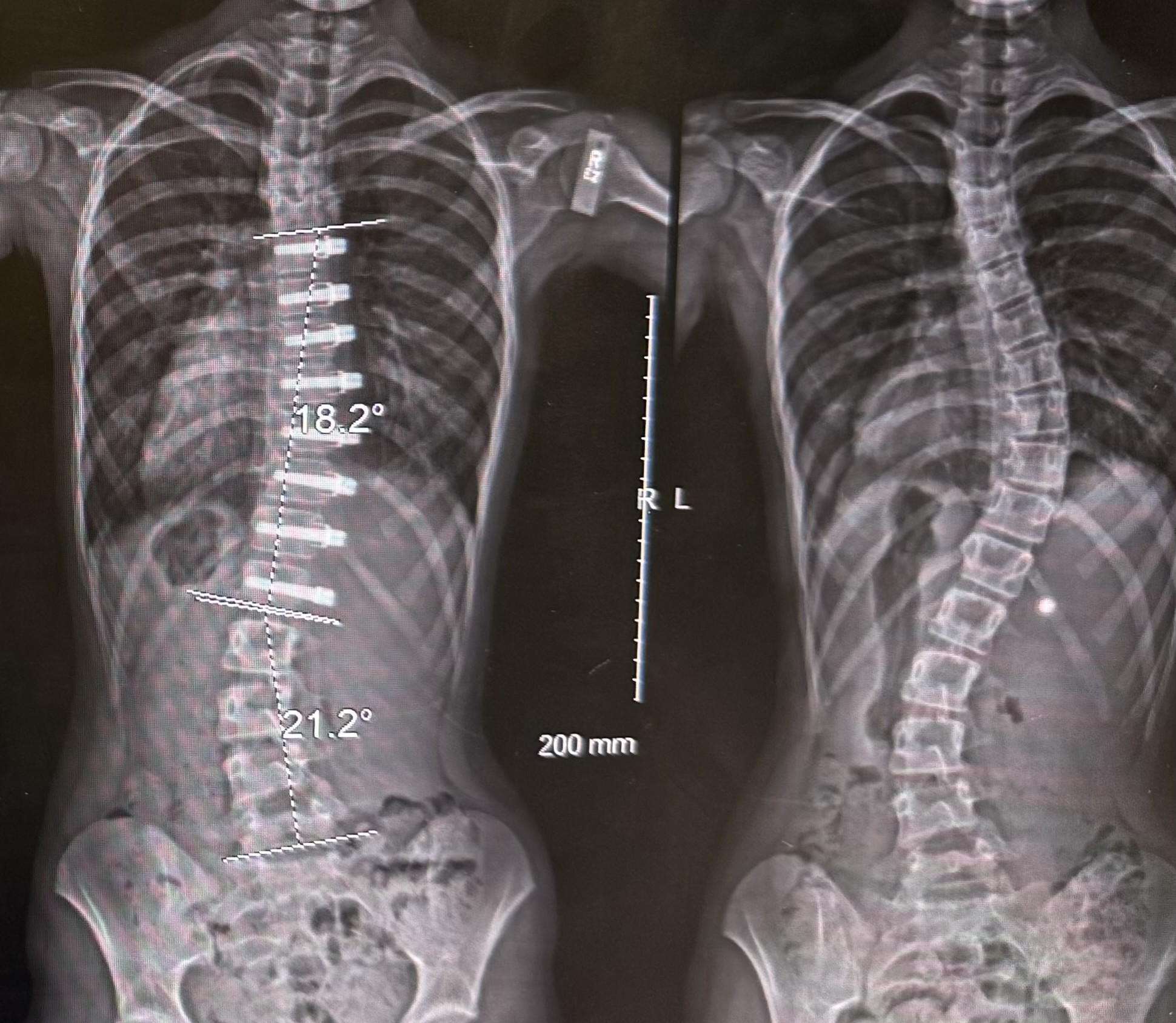 Xray Kate Lin